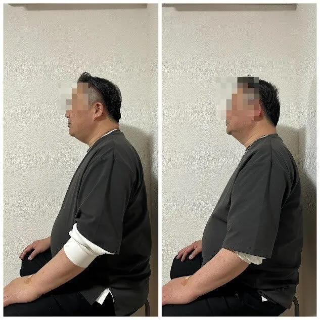 リモートワークで眼精疲労